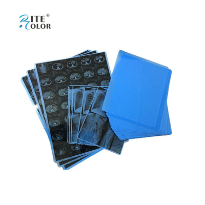 Impression par jet d'encre de film médical bleu PET pour rayons X en feuilles A4 8x10 14x17