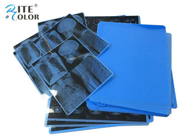 11 x 14 film sec médical de X Ray de jet d'encre d'ANIMAL FAMILIER du film A4 de représentation de laser de pouce pour le MRT de CR de CT