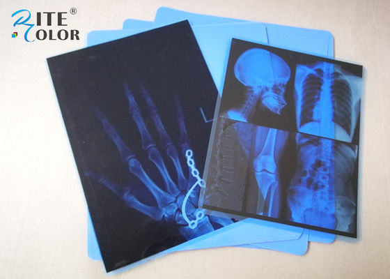 Film bleu d'imagerie médicale de jet d'encre d'ANIMAL FAMILIER de bas brouillard 8 x 10 pouces pour l'imprimante d'Epson