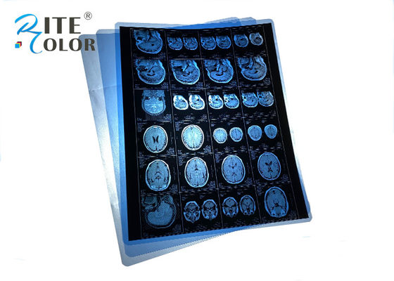 Films de rayons X médicaux PET bleus étanches pour IRM CT CR Sortie d'images panoramiques dentaires