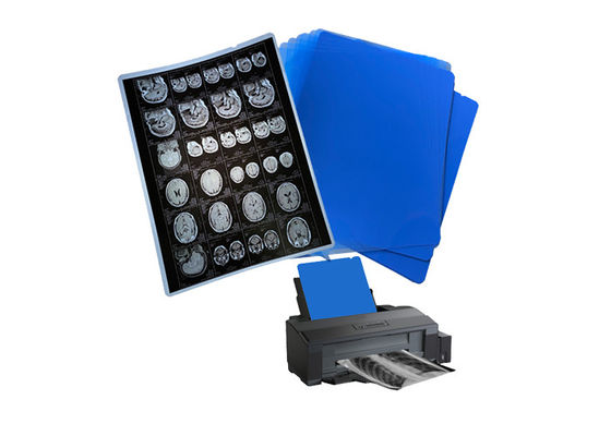 210um 8x10 A3 A4 Film à jet d'encre médical bleu pour la radiologie